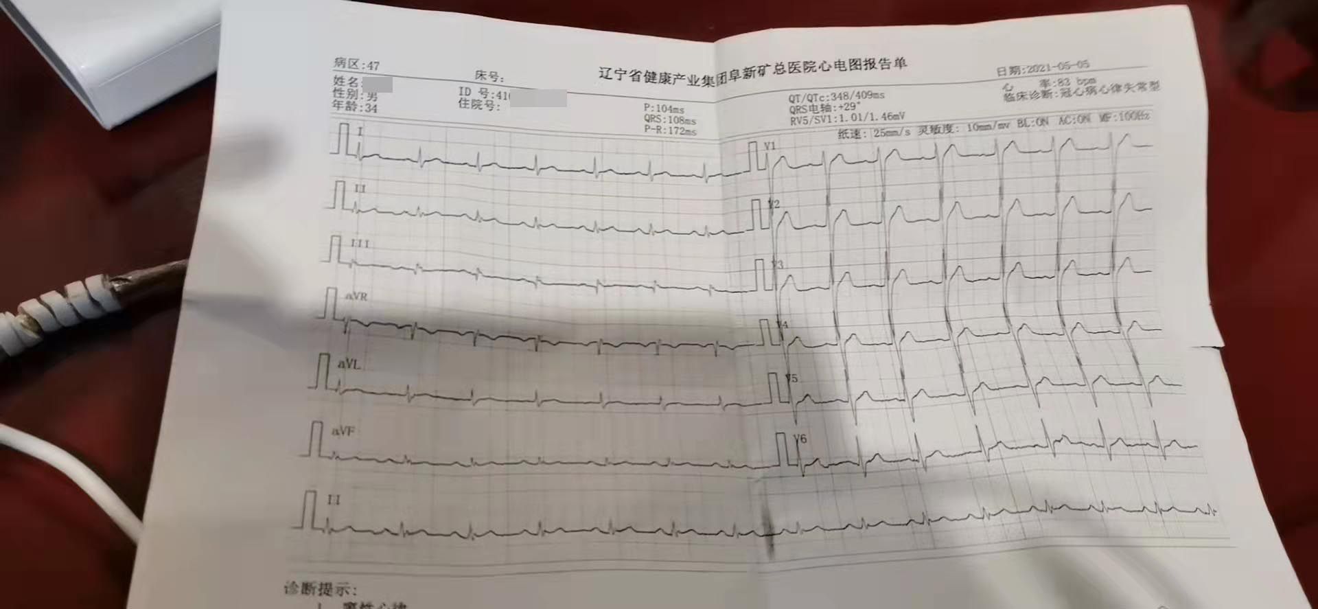体育生心脏T波异常，探究、分析与建议