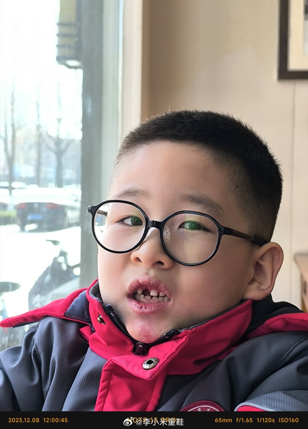 学生体育课意外摔伤事件，反思与启示