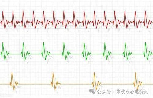 提升体育生心率的有效方法或策略
