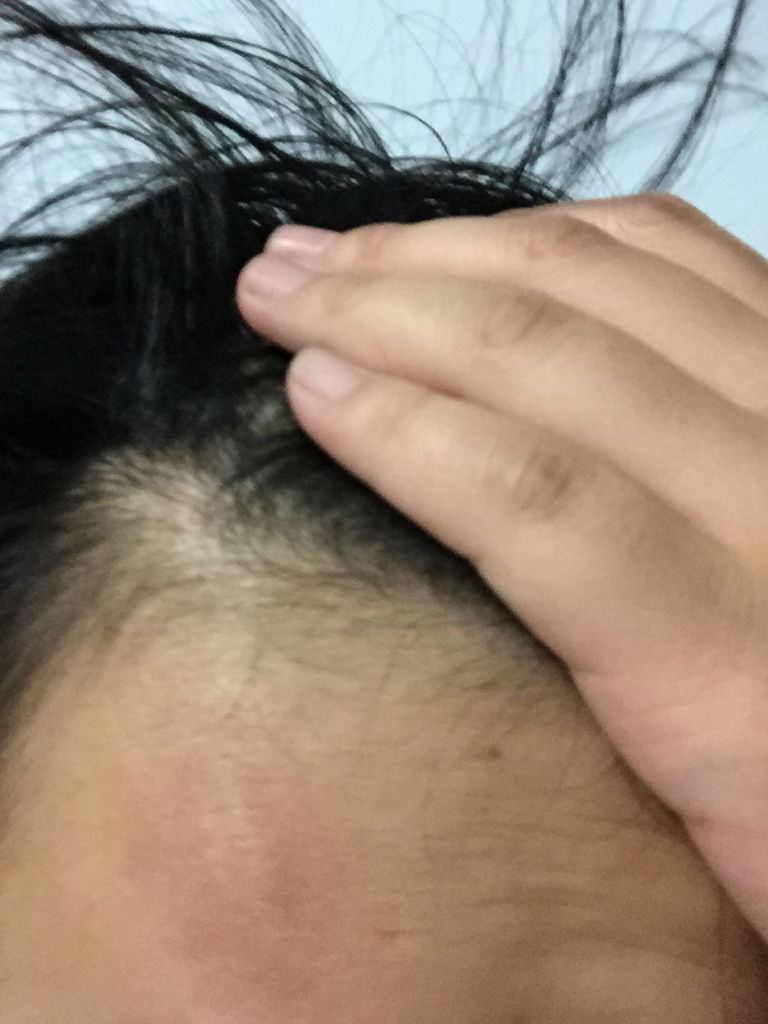 体育训练后脑门发胀，原因、影响及应对方法