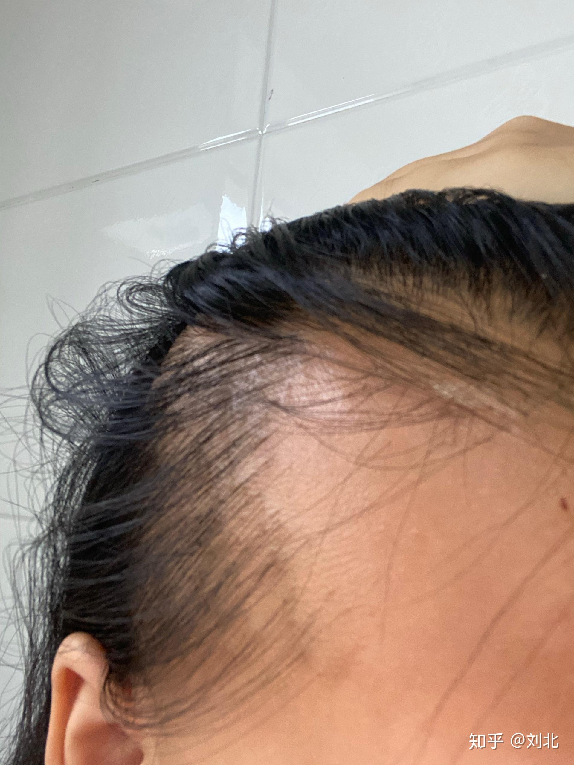 体育训练后脑门发胀，原因、影响与应对策略